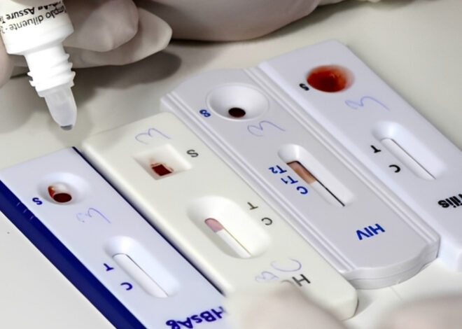 Há testes de diagnóstico de malária e HIV defeituosos à venda no País – O País