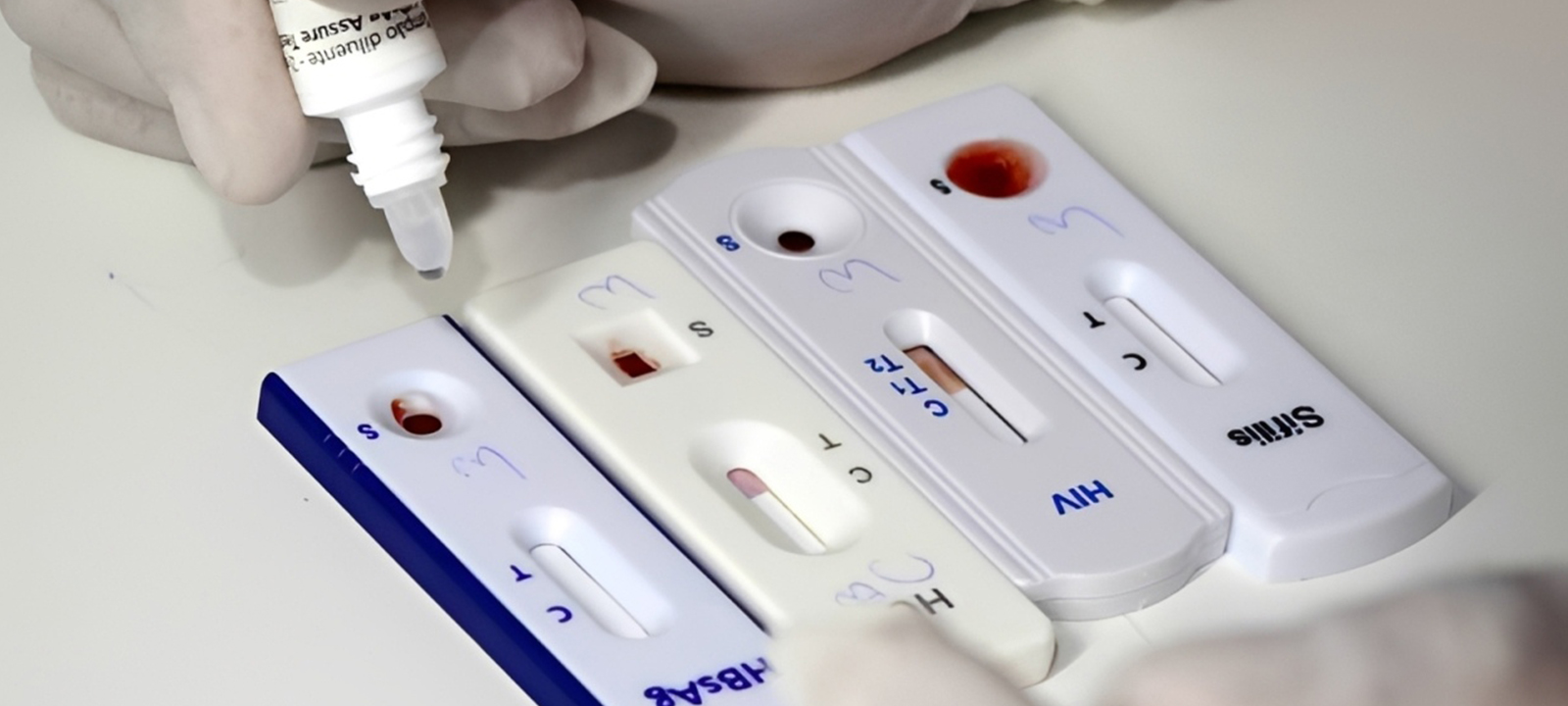 Há testes de diagnóstico de malária e HIV defeituosos à venda no País – O País