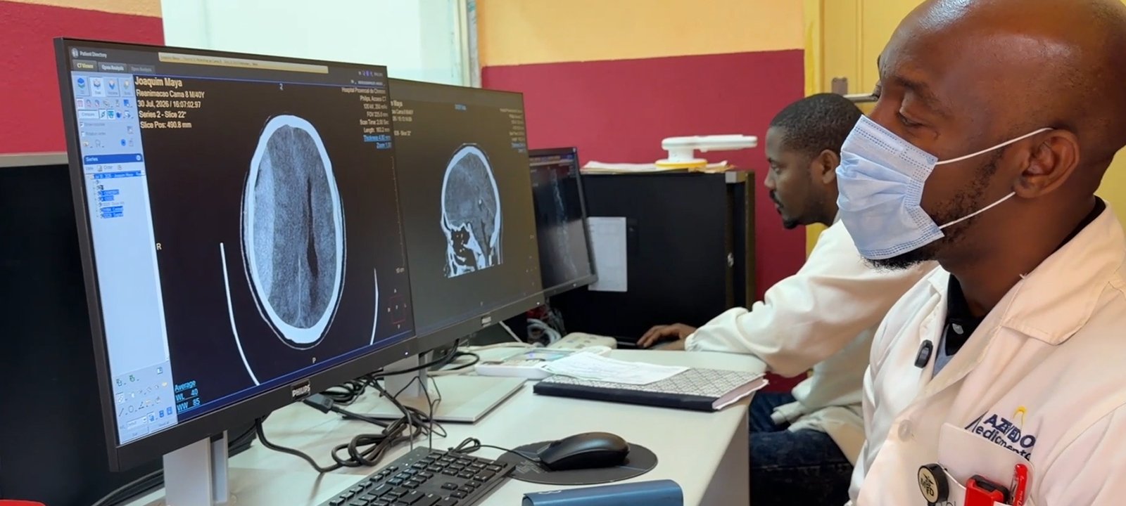 Hospital Provincial de Chimoio realiza primeira craniotomia de emergência – O País
