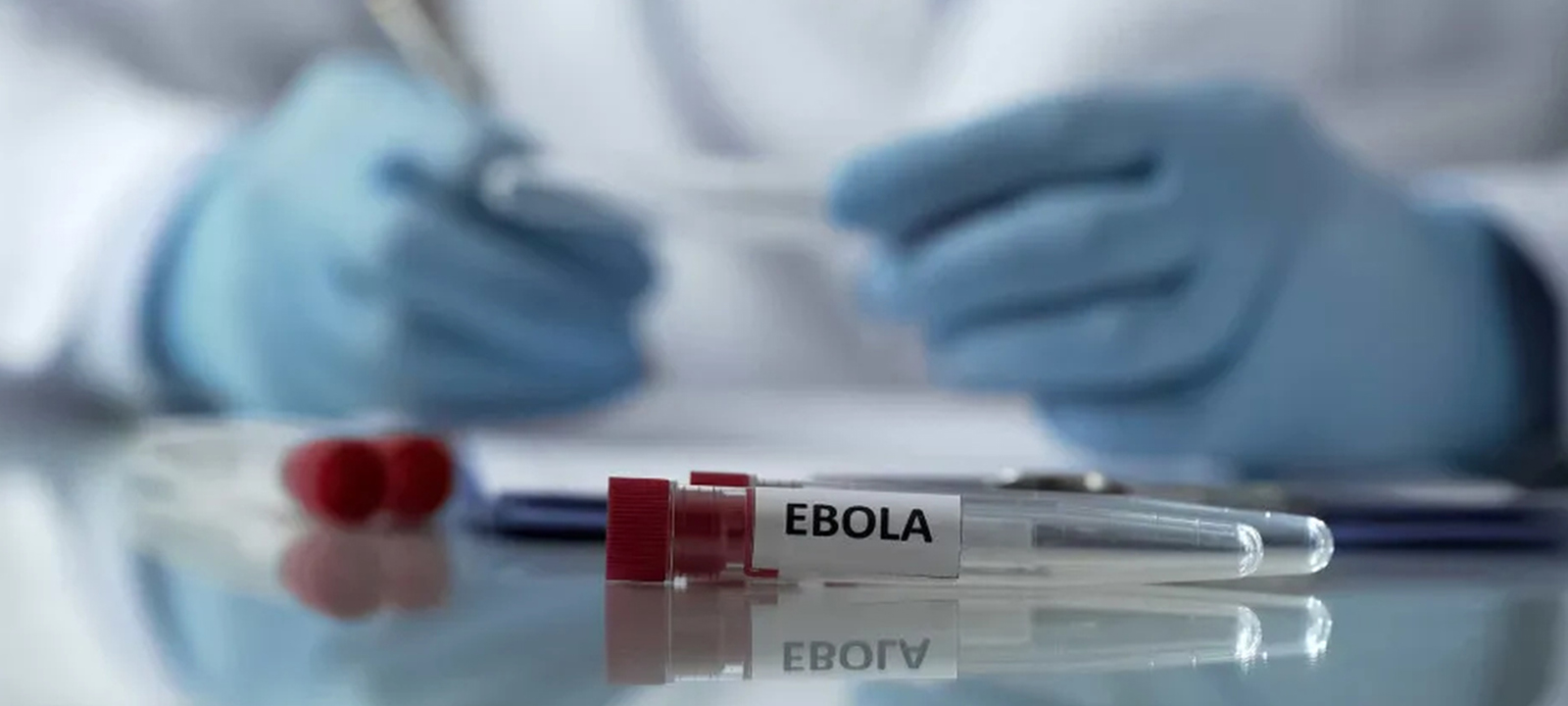 OMS recomenda ensaio clínico de vacina contra vírus Bundibugyo na RDC – O País