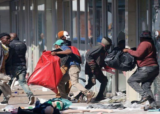 Moçambicano vítima de xenofobia está entre a vida e a morte em KwaZulu-Natal – O País